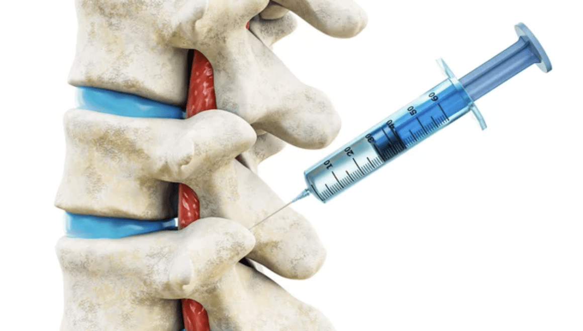 A person is getting their spinal cord injected.