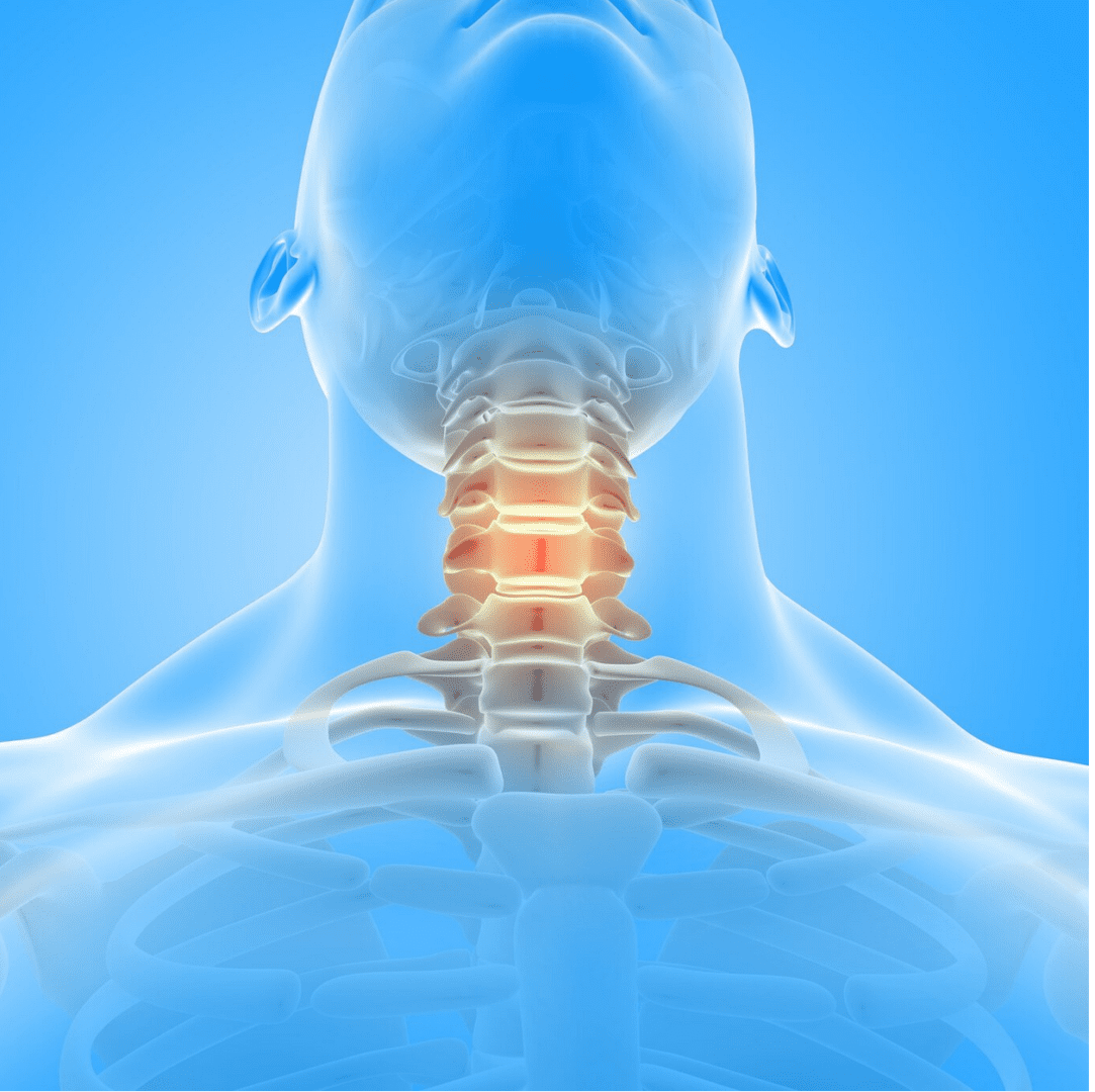 motion sparing neck surgeries